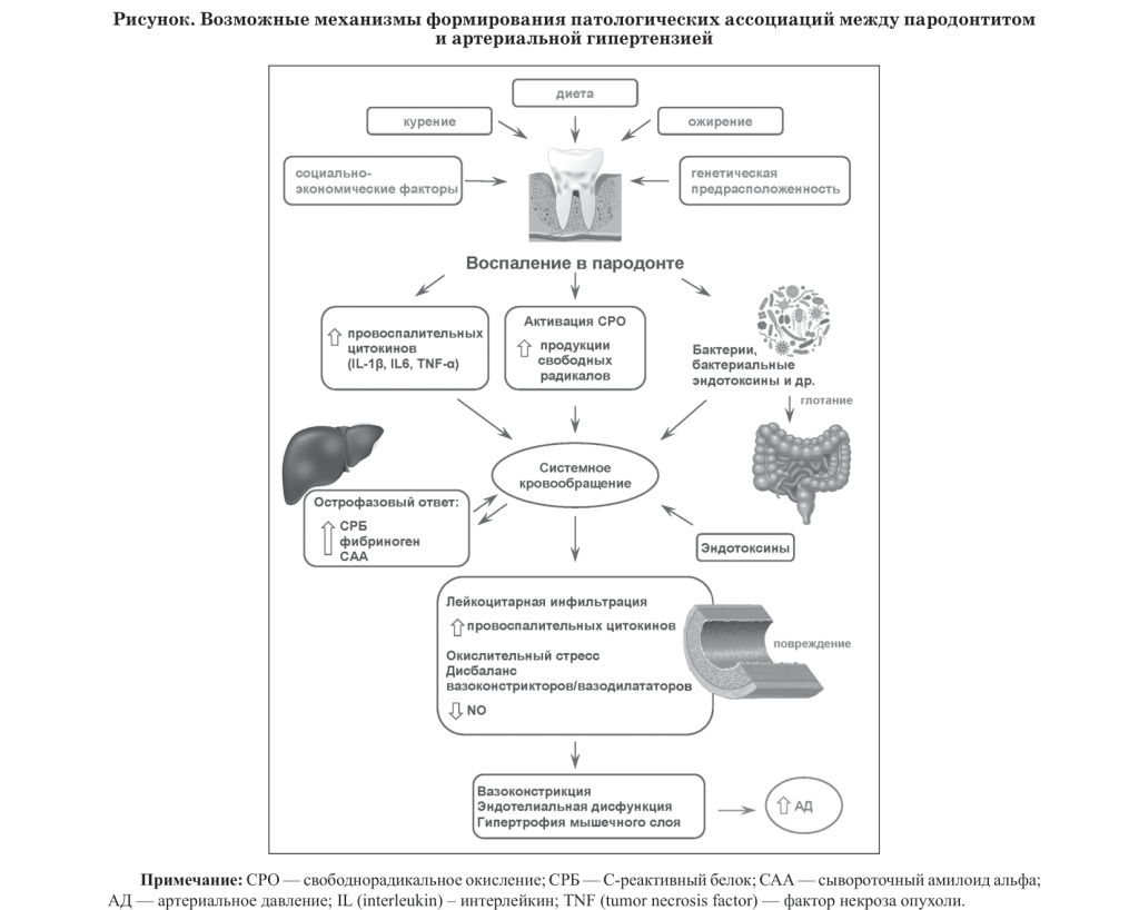 arterialnaya-gipertenziya-i-parodontit-klyuchevye-aspekty-komorbidnosti-1-11-1-11-6-1.png